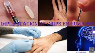 Iniciación de implantación de chips en humanos [upl. by Irrek]