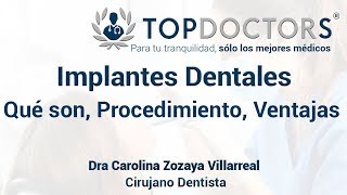 Implantes Dentales Qué son Procedimiento y Ventajas [upl. by Ode]