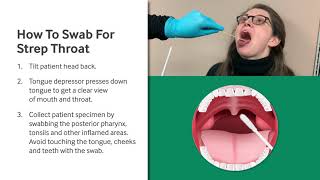 How to Swab for Strep Throat [upl. by Noyart]