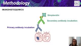 IV ISEP  Presentation Evaluation of protein NKX31 immunostaining in prostate carcinoma tissues [upl. by Inilahs331]