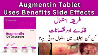 How To Use Augmentin 625mg Tablets Used For In Urdu  Side Effects [upl. by Elva318]