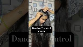 Dandruff control serum trending hairstyle youtubeshorts viralvideo shorts longhair hair [upl. by Tevlev613]