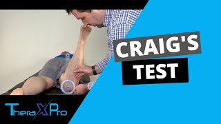 Craigs Test  Femoral Anteversion  Femoral Retroversion [upl. by Ozkum703]