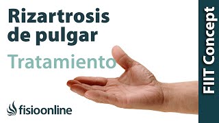 Rizartrosis o artrosis del pulgar  Visión desde la fisioterapia y la medicina natural [upl. by Abe]