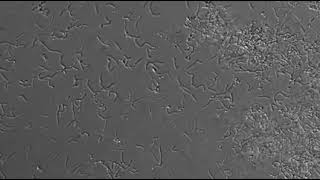 Planktonic Bacteria Swimming Around a BioFilm [upl. by Lampert]