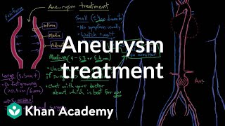 Aneurysm treatment  Circulatory System and Disease  NCLEXRN  Khan Academy [upl. by Yeldar706]