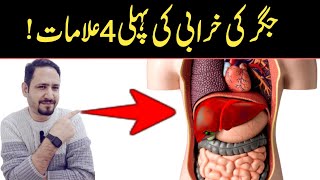 Your Liver is Dying 4 Weird Signs amp Symptoms of Liver Problems In Urdu Hindi  Irfan Azeem [upl. by Pitzer]