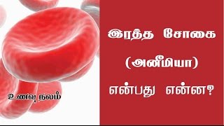 இரத்த சோகையை தடுக்கும் உணவுகள் – Anemia Foods [upl. by Labotsirhc]