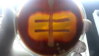 hemodigestion of blood agar Hemolysis differences [upl. by Aivatnwahs770]