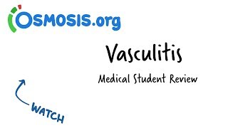 Vasculitis  Clinical Presentation [upl. by Ahsenat296]