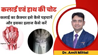 कलाई की हड्डी टूटना  Wrist Fracture  Scaphoid Fracture  Wrist Fracture Exercise in Hindi [upl. by Lainey]