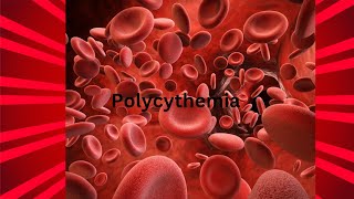 Polycythemia definition  Polycythemia rubra veratypes causes Sings and symptoms [upl. by Carl]