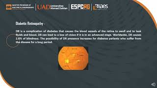 Identification of Ocular Disease from fundus images using CNNwith Transfer Learning [upl. by Yevrah575]