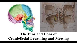 The Pros amp Cons of Craniofacial Breathing and Mewing [upl. by Rap517]