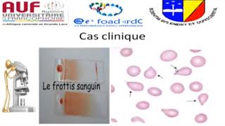 MORPHOLOGIE EN HEMATOLOGIE EPISODE 5 [upl. by Sargent655]