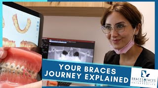 Your Braces Journey Explained Start to Finish  Braces N Faces Orthodontic Clinic Hoppers Crossing [upl. by Beata]