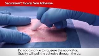 SecureSeal® Topical Skin Adhesive  Cardinal Health [upl. by Alleoj308]