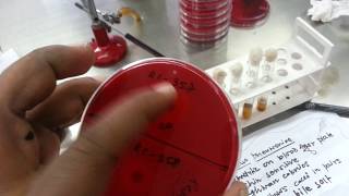 Optochin test for Streptococcus pneumoniae [upl. by Reginauld852]