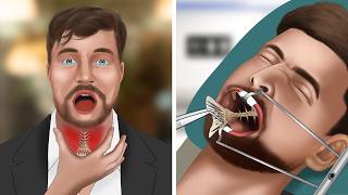 ASMR Animation Remove fish bones stuck in MrBeasts throat [upl. by Sawyor]