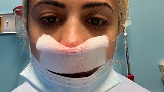 Septoplasty Surgery Experience [upl. by Ahsemot]