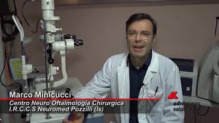 Cheratocono patologia degenerativa della cornea [upl. by Lacombe]