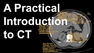 A Practical Introduction to CT [upl. by Constanta]