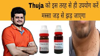 Thuja इस तरह से उपयोग करें मस्सा जड़ से झड़ जाएगा  Warts  Homeopathic Medicine  How to use [upl. by Asiilanna]