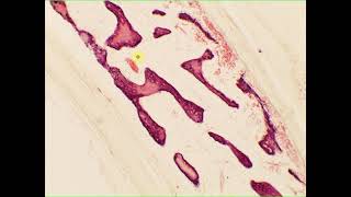 Intramembranous ossification cancellous spongy bone flatbone skull [upl. by Tavie470]