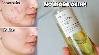 Bali Skin Tea Tree Toner  Honest Review  Best for Acne [upl. by Yablon]