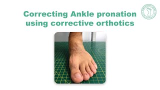 Correcting Ankle pronation using corrective orthotics [upl. by Lena261]