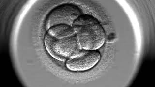 IVF Gynem Klinik  EmbryoScope  Entwicklung des Embryos [upl. by Lundgren]