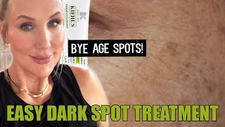 Easy Dark Spot Treatment  Melasyl  Kiehls Auto Tone hyperpigmentation [upl. by Urias]