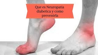 Que es neuropatia diabetica y como prevenirla [upl. by Hadden]