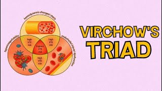 VIRCHOWS TRIAD  THE 3 KEY CAUSES OF THROMBI [upl. by Amalee]