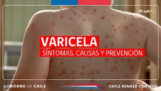 VARICELA Síntomas Causas y Prevención [upl. by Sherilyn]