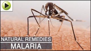 Malaria Natural Ayurvedic Home Remedies [upl. by Poll781]