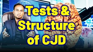 Tests amp Structure Function of Brain in CJD Creutzfeldt Jakob Disease Prion Disease Mad Cow CWD [upl. by Eibur]