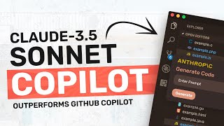 Claude35 Sonnet  Qwen2  ContinueDev  This AMAZING Coding Copilot BEATS Github Copilot amp Others [upl. by Yorgos]