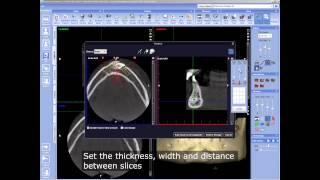 Saving stacks created with 3D Volume Reslicer Tool in Planmeca Romexis® software [upl. by Livy]