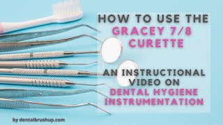 How to use the Gracey 78 Curette [upl. by Aicinoid500]