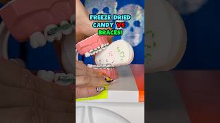 Is FREEZE DRIED CANDY safer for BRACES Orthodontist Tries and REACTS braces candy shorts [upl. by Doll]