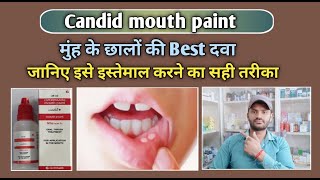 Candid mouth paint use dose benefits and Side effects full review in hindiClotrimazole [upl. by Fahy53]