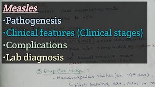 Measles  Pathogenesis  Clinical features  Complications  Lab diagnosis [upl. by Suckram780]