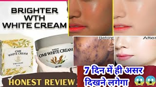 OMI White CreamMeeshoOmi white Cream honest review 2023korean Skin whitening cream review hindi [upl. by Winnah752]