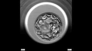 EmbryoScope Embryo Development  Blastocyst [upl. by Rock]