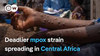 With deadlier mpox strain spreading in Central Africa whats holding up vaccinations   DW News [upl. by Iccir]