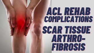 ACL Surgery  SCAR TISSUE  Arthrofibrosis [upl. by Nailuj]