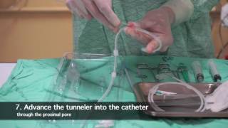 TK Catheter insertion for peritoneal dialysis by nephrologist [upl. by Kreiner]