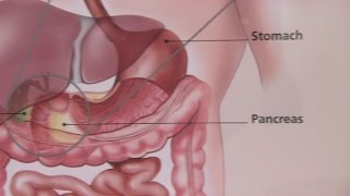 Irritable Bowel Syndrome amp Its Symptoms [upl. by Dillon]