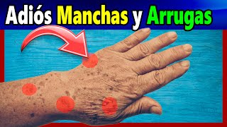 Quita las Arrugas y manchas de las Manos Solo Aplica 1 de estos 3 remedios caseros [upl. by Leilah]